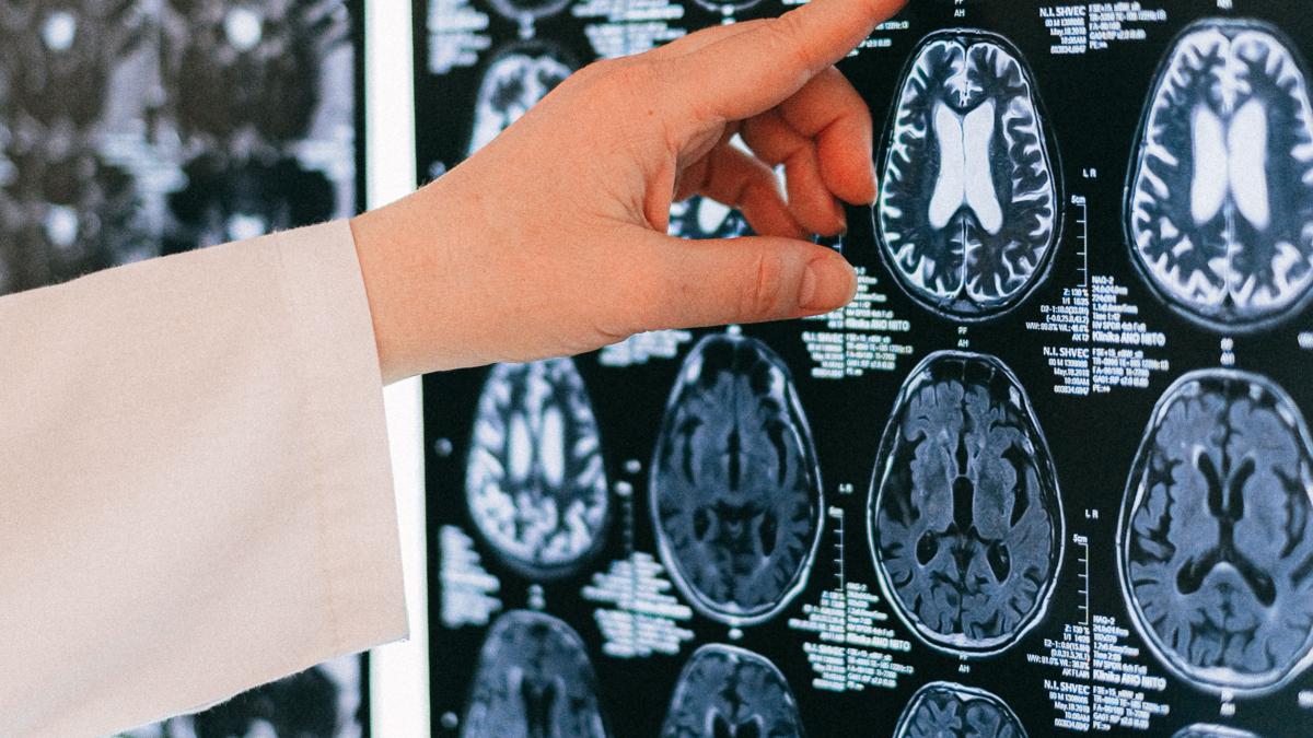 Sfaturile medicului Dafin Mureșanu pentru menținerea sănătății creierului în era digitală